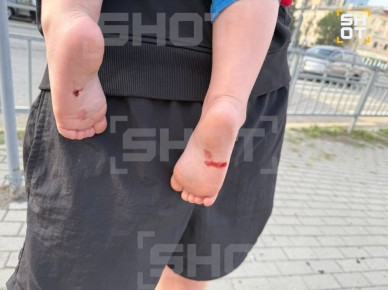 В квартире на Плехановской улице в Воронеже пострадал годовалый малыш