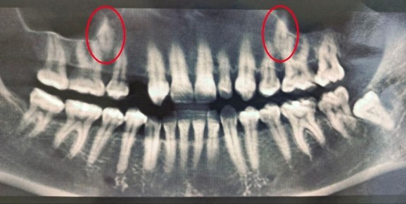 ����������� ����������� ������� 38-������ ������� � ����� ���������������� ������ � �������� ����