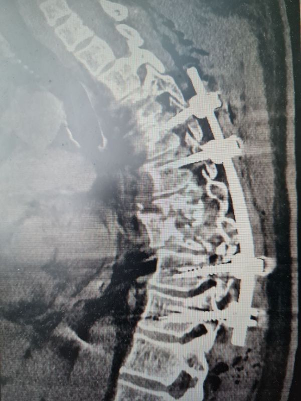 ����������� ����� ������ ������������� � ��� ������� � �������� �������� ������ ������������