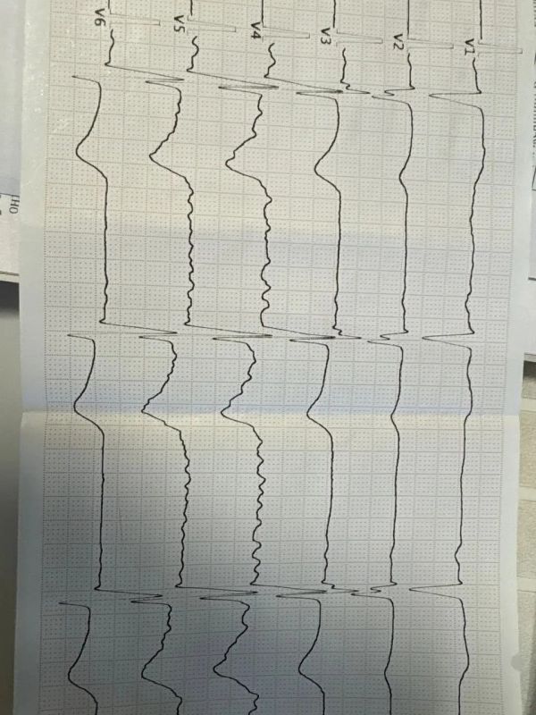 � 64-������� ��������� �� ����� ������ ������������ ������