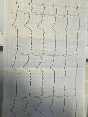 � 64-������� ��������� �� ����� ������ ������������ ������