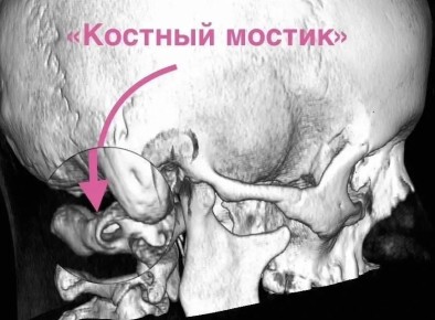 ���� � ��� 15 ���: ����������� ������������ ���������� ���� ������� �� �������� �����