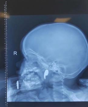 ����������� ������ ������� �������� ������ �� ���������� ����������������� �������