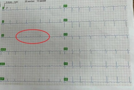 ������� ��������� ���� ���� � �������� � ������������� �������� � ��������