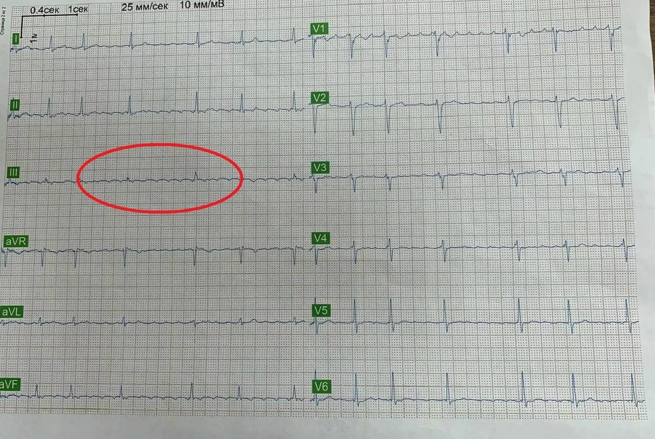 Супруга уговорила мужа лечь в больницу и предотвратила трагедию в Воронеже