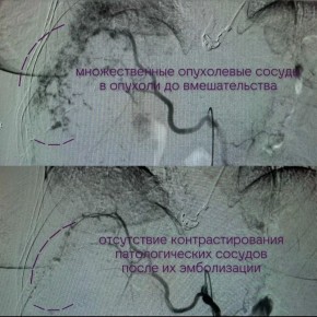 �������� �������������� ������� � ������ ����� ������� ������� ������� ����������� ��������