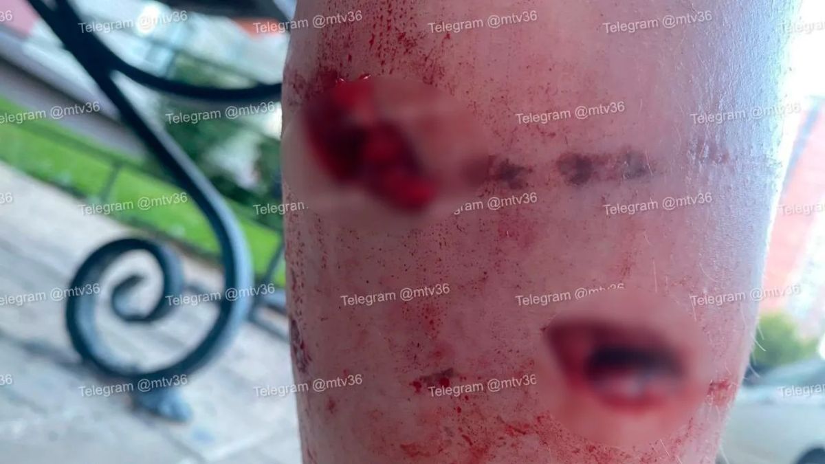 Собаки напали на двух девушек на Олимпийском бульваре Собаки напали на двух девушек на Олимпийском бульваре
