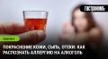 Как распознать аллергию на алкоголь: симптомы и причины