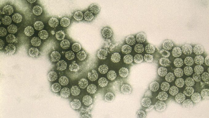 ���� ��� �������